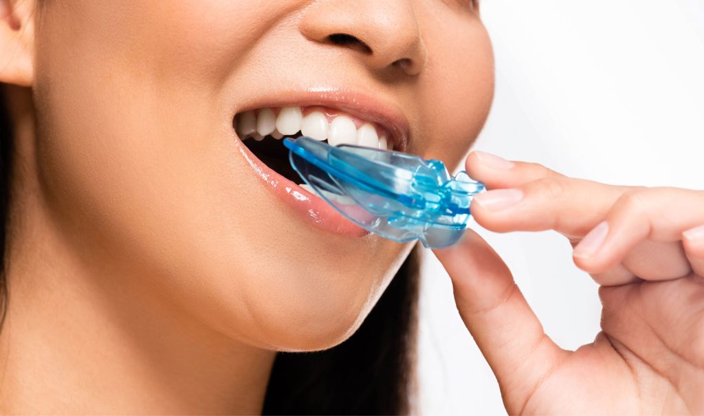 Mouthguards