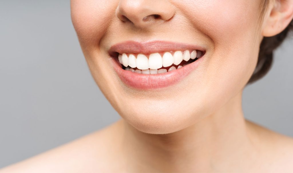 Woman Smile After Oral Surgery Boynton Beach, FL