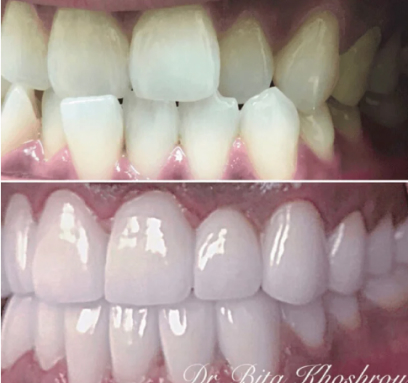 Trance Smile Transformation - After