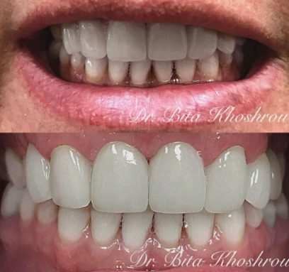 JuliaSmile Transformation - After