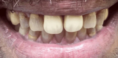 George Smile Transformation - Before