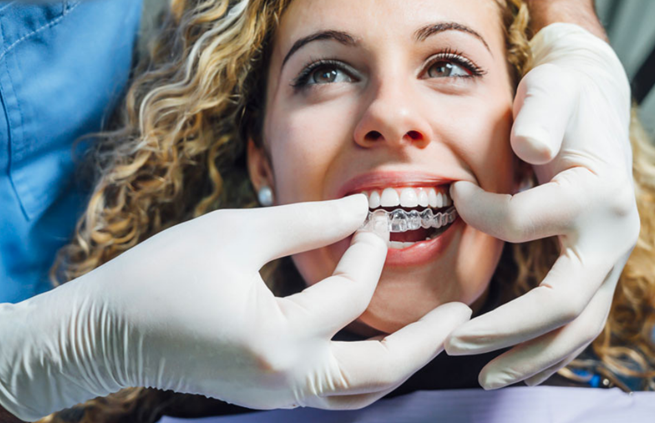 Dentist Fitting Clear Aligners On Woman’s Teeth