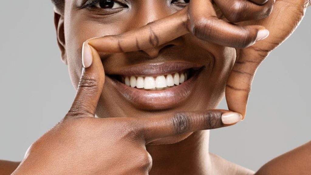 Woman Showing Bright Smile After Teeth Whitening