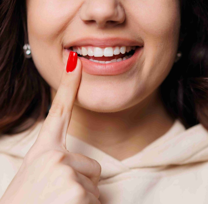 Woman Pointing At Her Teeth