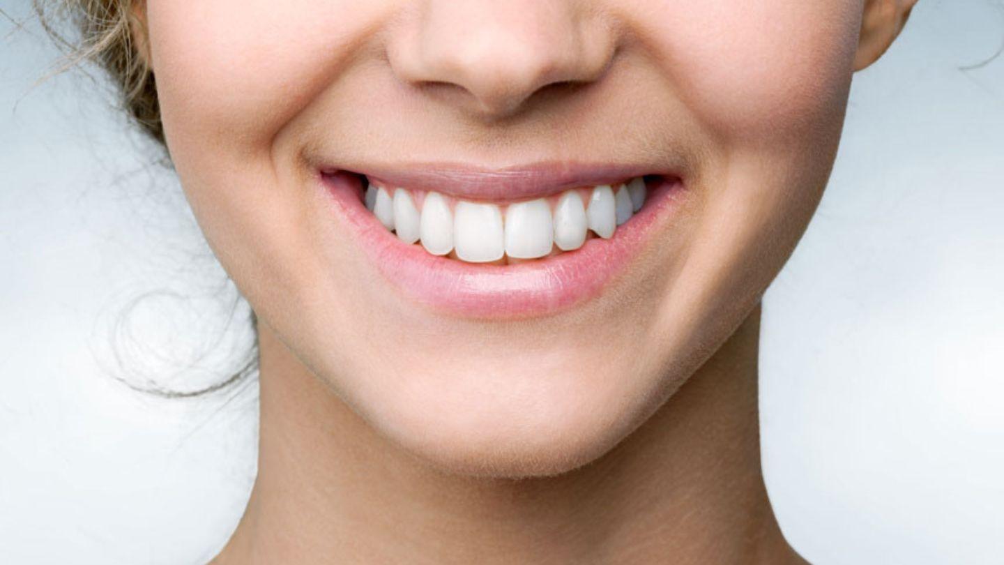 How Long Should You Wear Retainers After Invisalign?